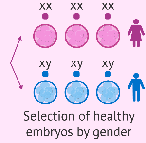 روش پی‌جی‌دی برای تعیین جنسیت و بررسی نقایص ژنتیکی جنین