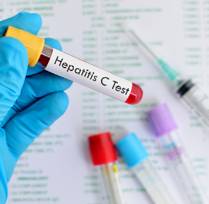 هپاتیت‌های ویروسی را بهتر بشناسیم!
