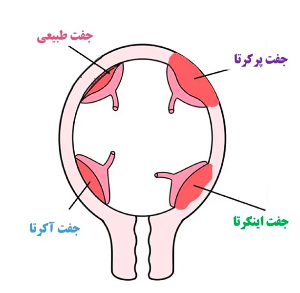 titleString